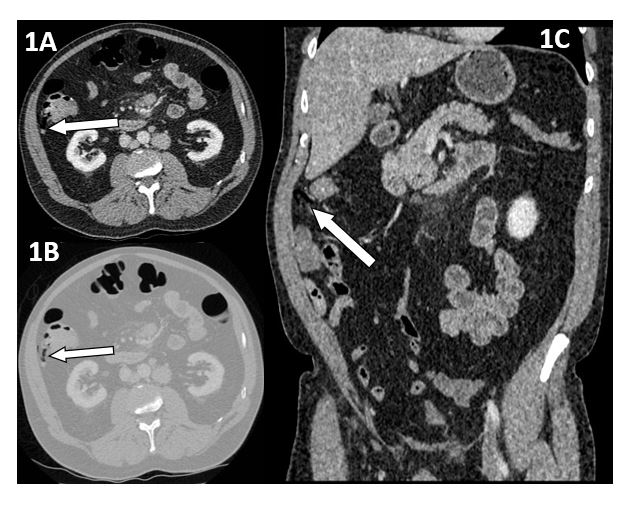 ijcgh1008-figure1