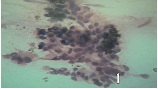 ijcgh1009-figure2