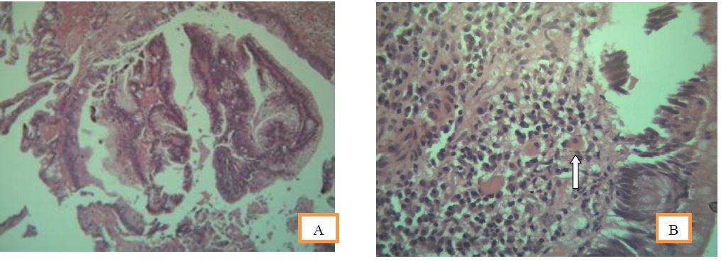 ijcgh1009-figure3