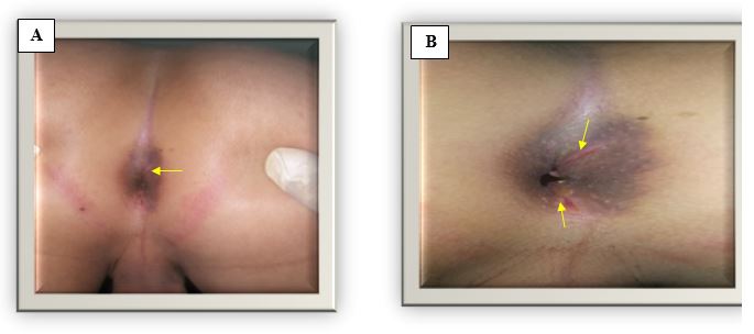 ijfs1007-figure11