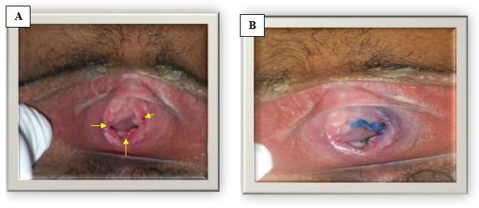 ijfs1007-figure3