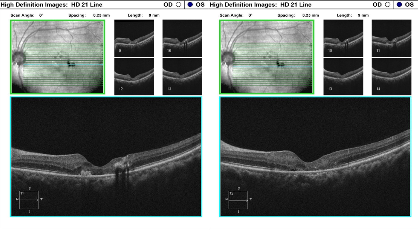 irjo1001-figure3