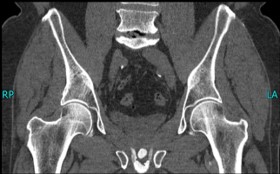 jcri1014-figure1