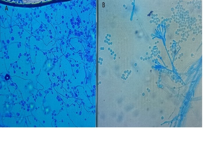 jcri1016-figure3