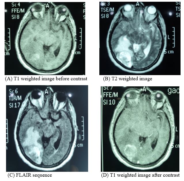 jcri0017-figure1