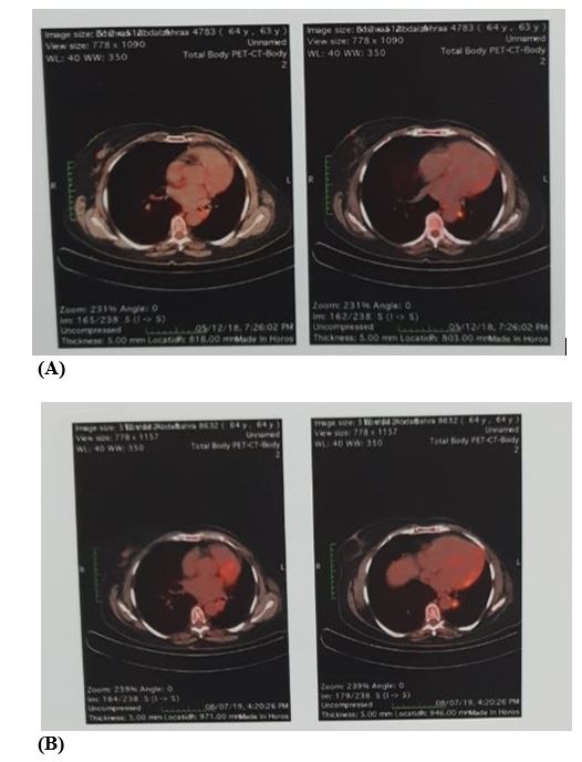 jcri0017-figure2