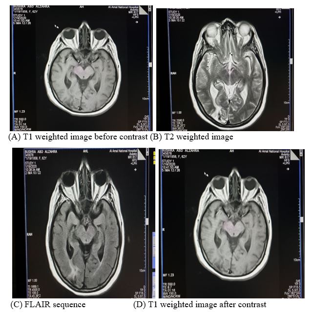 jcri0017-figure3