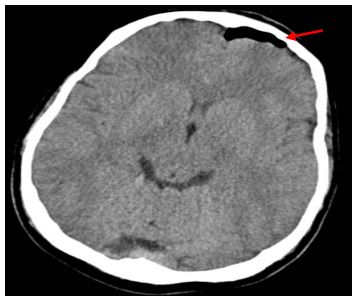 jcri1019-figure18