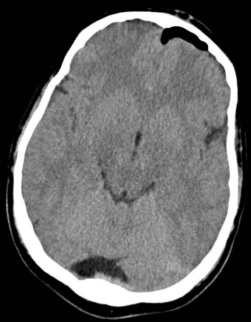 jcri1019-figure19