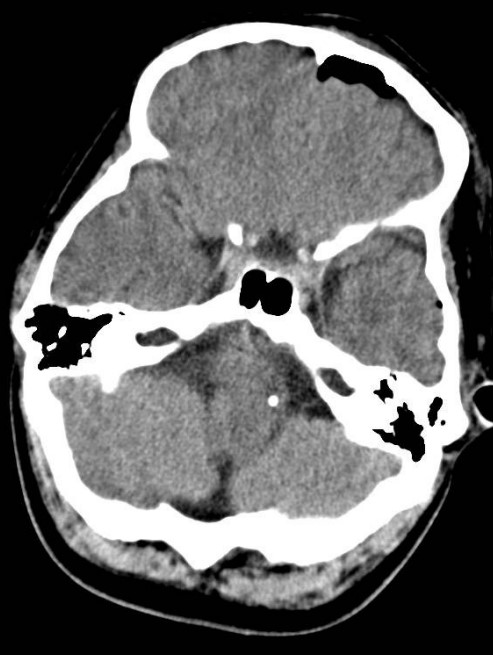 jcri1019-figure26