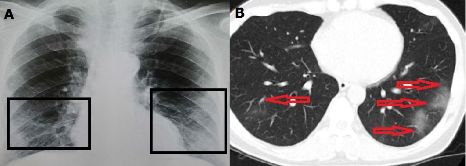 jcri1020_figure1