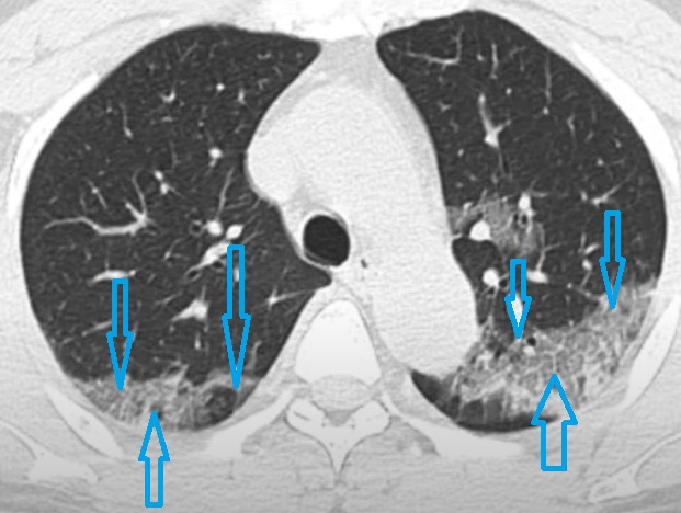 jcri1020_figure2