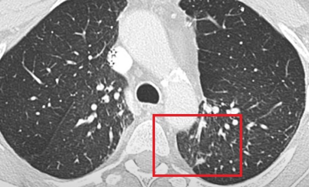 jcri1020_figure3