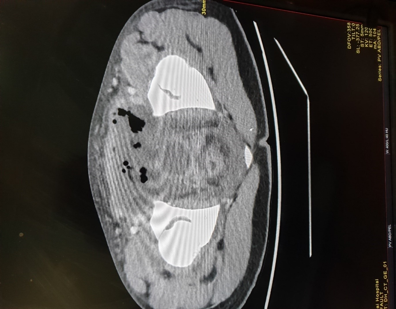 jcri1025_figure1