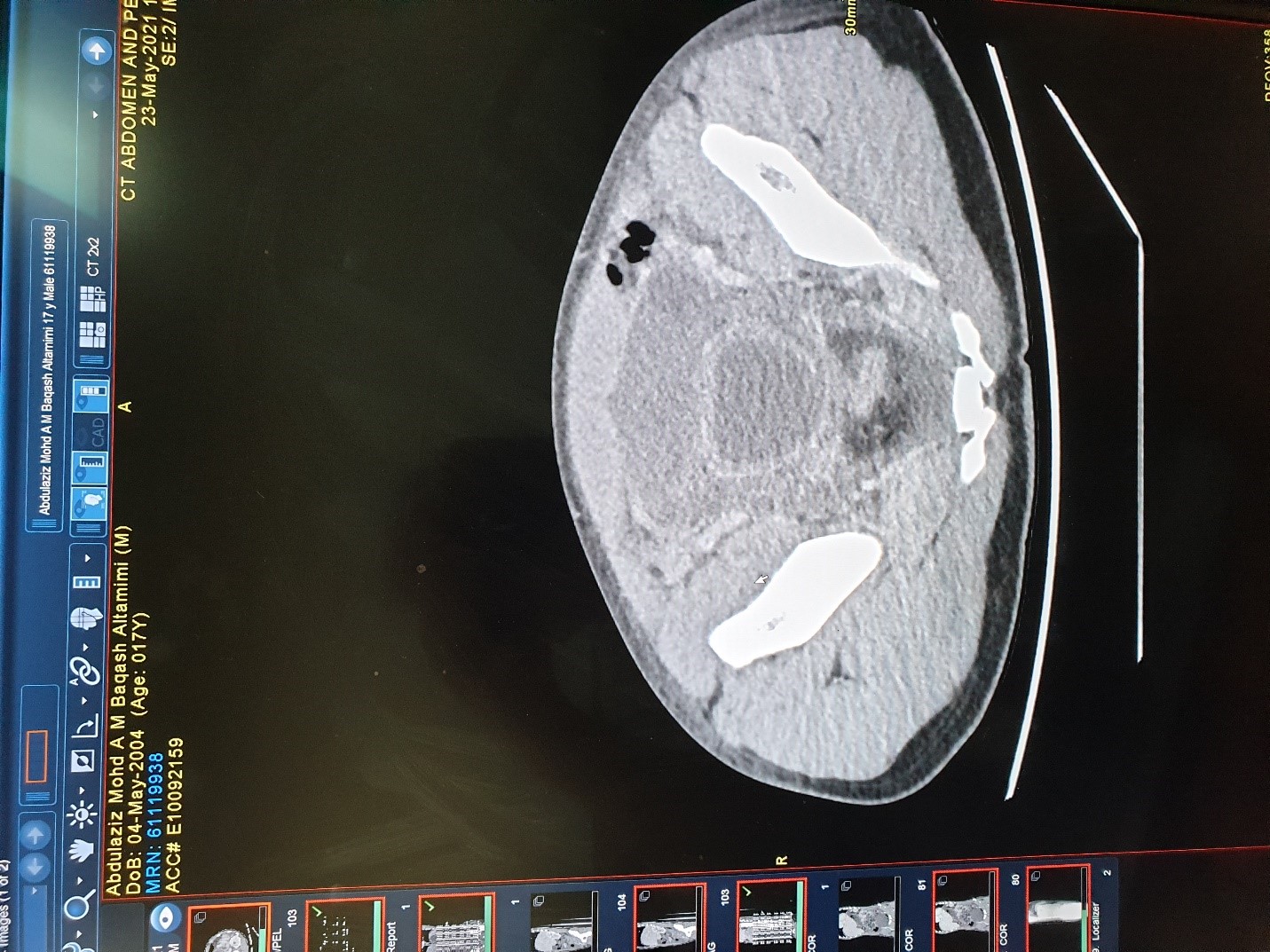 jcri1025_figure2