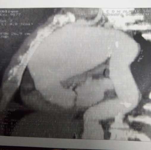 jcri1030_figure2