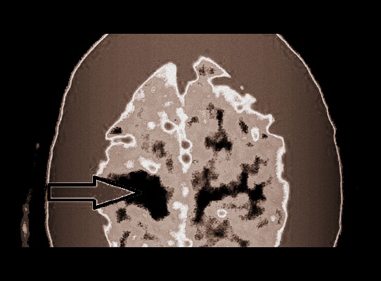 ojor1002_figure3