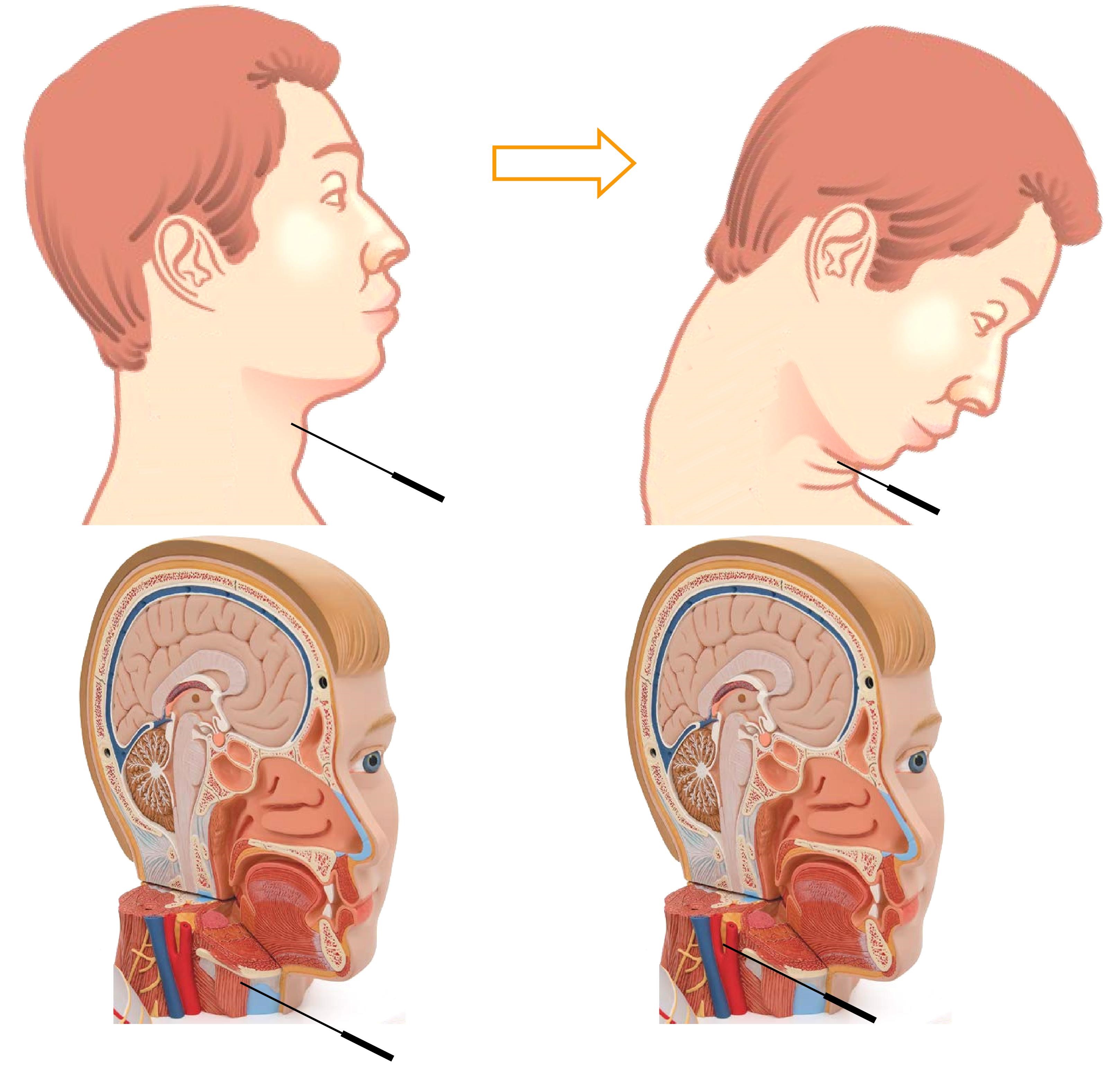 ojrmi1003-figure2