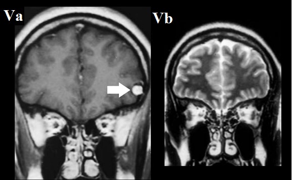ojrmi1009-figure5