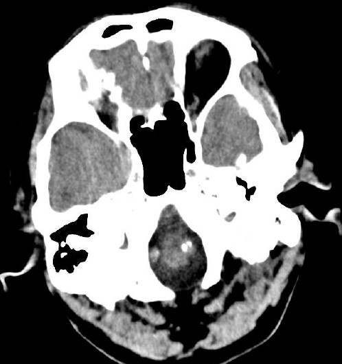 ojrmi1011-figure1
