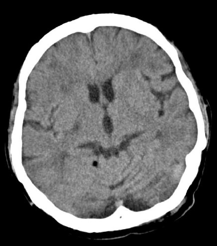 ojrmi1011-figure10
