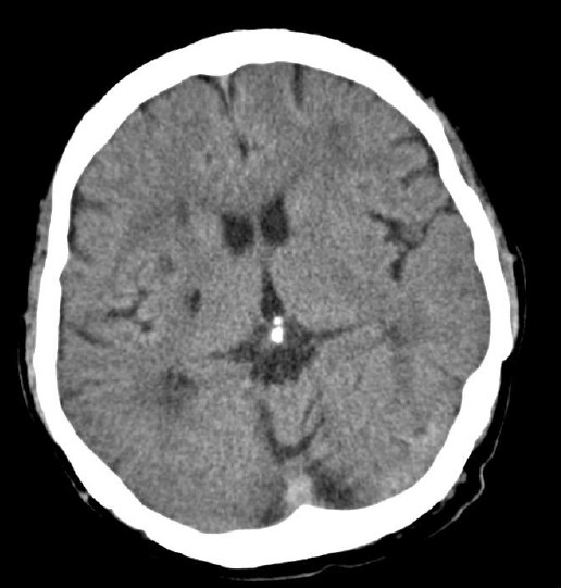 ojrmi1011-figure11