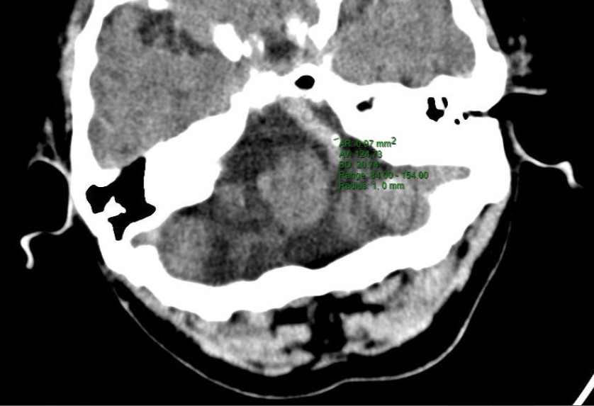 ojrmi1011-figure12