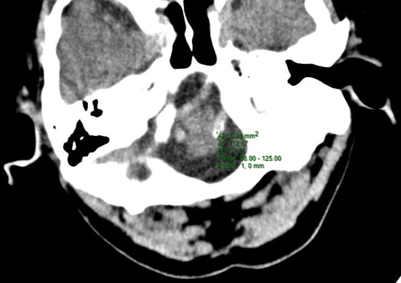 ojrmi1011-figure13