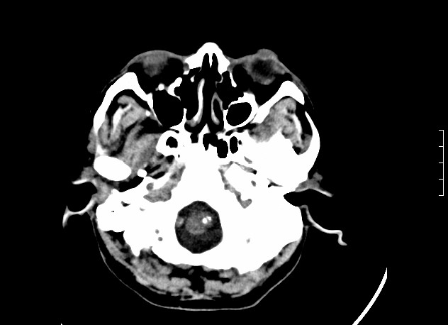 ojrmi1011-figure16