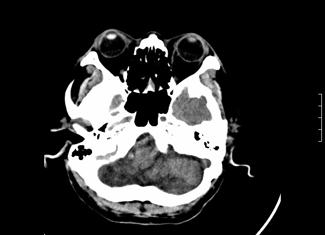 ojrmi1011-figure17