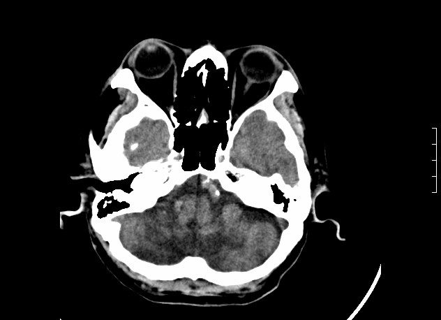 ojrmi1011-figure18