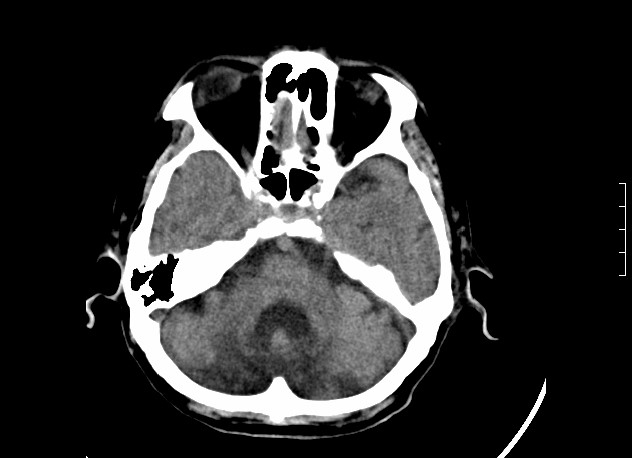 ojrmi1011-figure19