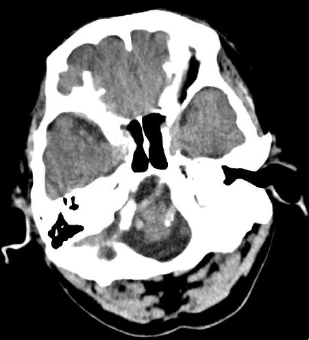 ojrmi1011-figure2