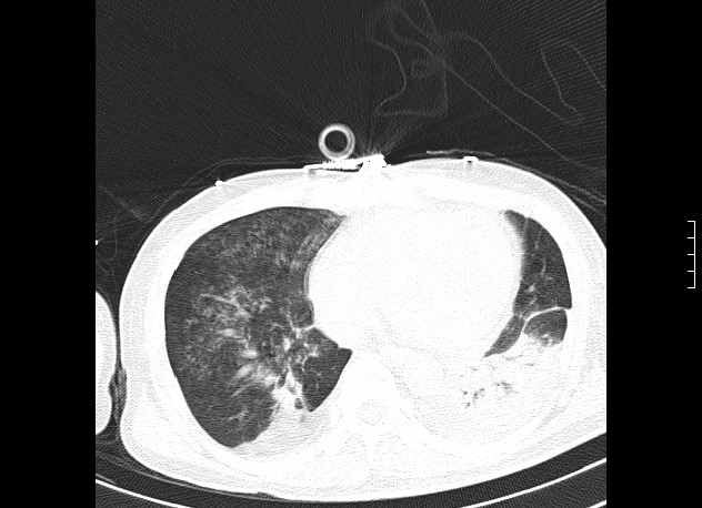 ojrmi1011-figure21