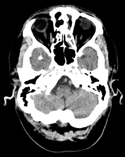ojrmi1011-figure23