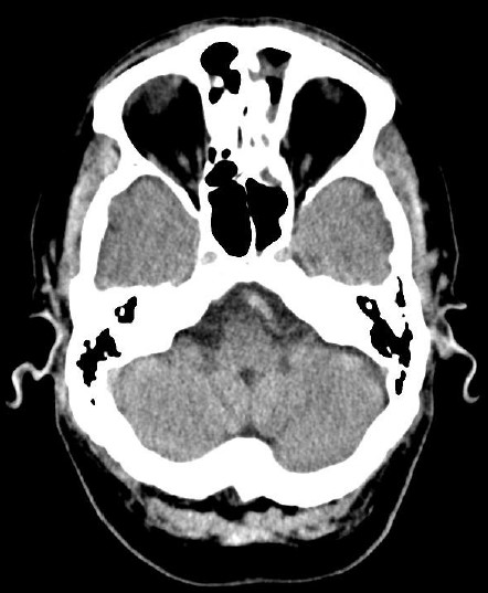 ojrmi1011-figure24