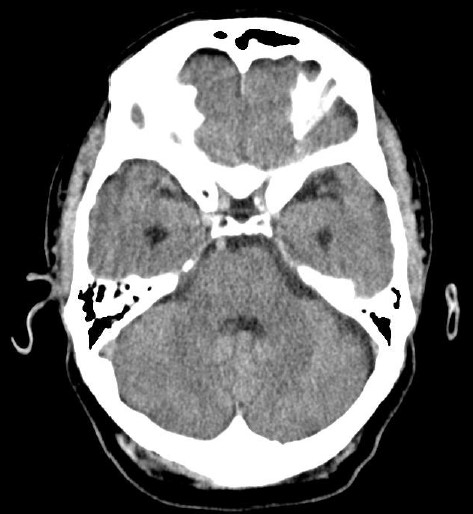 ojrmi1011-figure25