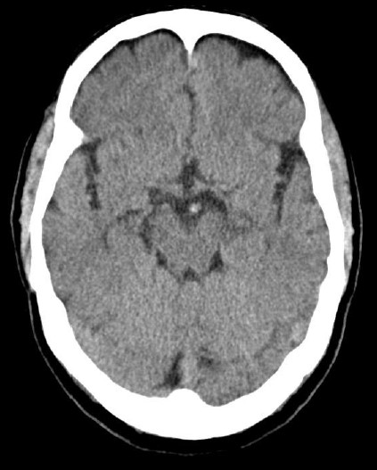 ojrmi1011-figure26