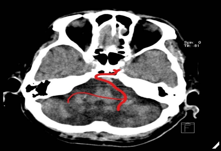 ojrmi1011-figure28