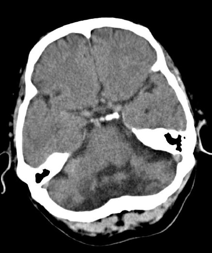 ojrmi1011-figure5