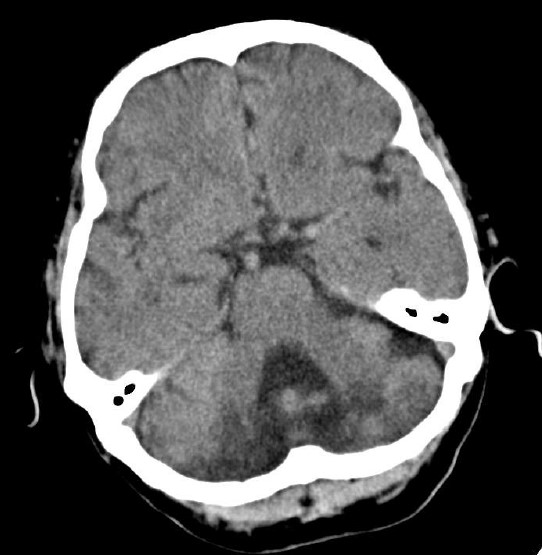 ojrmi1011-figure6