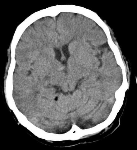 ojrmi1011-figure9